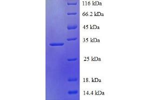 SDS-PAGE (SDS) image for PDZ Domain Containing 11 (PDZD11) (AA 1-140), (full length) protein (His-SUMO Tag) (ABIN5711387)