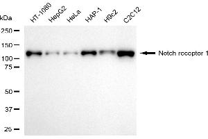 Western blotting analysis using notch receptor 1 antibody (ABIN7799625). (Recombinant Notch1 anticorps)