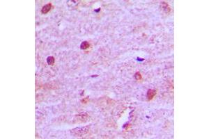 Immunohistochemical analysis of MNAT1 staining in human brain formalin fixed paraffin embedded tissue section. (MNAT1 anticorps  (Center))