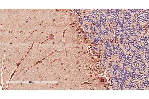 Antibody (2µg/ml) staining of paraffin embedded Human Cerebellum. (Doublecortin anticorps  (AA 232-242))