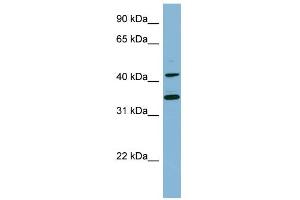 WB Suggested Anti-BLNK Antibody Titration:  0. (B-Cell Linker anticorps  (Middle Region))