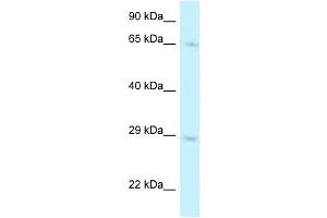 Western Blot showing MUS81 antibody used at a concentration of 1 ug/ml against A549 Cell Lysate (MUS81 anticorps  (C-Term))