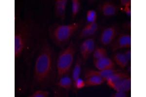 Immunofluorescence staining of methanol-fixed HeLa cells using NF-κB p105/p50 (phospho- Ser893) antibody (E011018 Red). (NFKB1 anticorps  (pSer893))