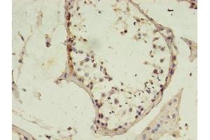 Immunohistochemistry of paraffin-embedded human testis tissue using ABIN7150209 at dilution of 1:100 (MSH6 anticorps  (AA 1-400))