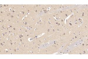 Detection of SEMA3A in Human Cerebrum Tissue using Monoclonal Antibody to Semaphorin 3A (SEMA3A)