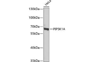 Western blot analysis of extracts of HeLa cells, using PIP5K1A antibody  at 1:1000 dilution.