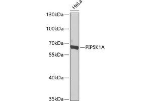 Western blot analysis of extracts of HeLa cells, using PIP5K1A antibody  at 1:1000 dilution. (PIP5K1A anticorps  (AA 231-500))