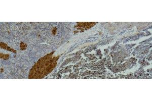 Immunohistochemistry of paraffin-embedded Mouse spleen tissue using IL2RA Monoclonal Antibody at dilution of 1:500 . (CD25 anticorps)