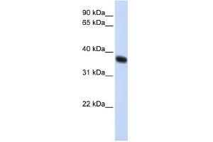 WB Suggested Anti-ZNF364 Antibody Titration:  0. (RNF115 anticorps  (C-Term))