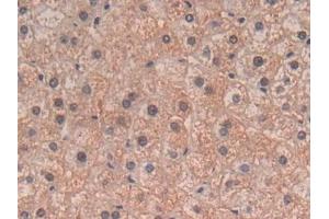 Detection of TGFb3 in Human Liver Tissue using Polyclonal Antibody to Transforming Growth Factor Beta 3 (TGFb3) (TGFB3 anticorps  (AA 24-300))