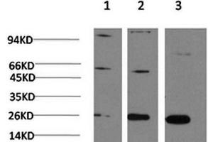 Western Blot analysis of 1) Hela, 2)3T3, 3) PC-12 cells using CBX3 Monoclonal Antibody at dilution of 1:1000. (CBX3 anticorps)