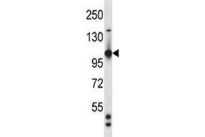 Tie1 antibody western blot analysis in mouse heart tissue lysate (TIE1 anticorps  (AA 361-389))