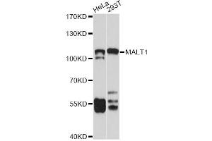 Western blot analysis of extracts of various cell lines, using MALT1 antibody (ABIN5971171) at 1/1000 dilution. (MALT1 anticorps)