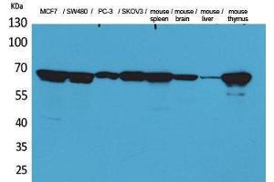 Western Blotting (WB) image for anti-Lamin B1 (LMNB1) (Internal Region) antibody (ABIN6283615)