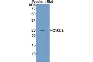 Western blot analysis of the recombinant protein. (GCLC anticorps  (AA 435-636))