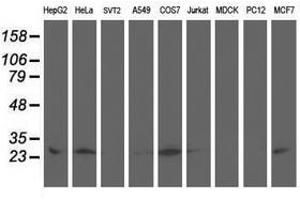 Image no. 3 for anti-Adenylate Kinase 4 (AK4) antibody (ABIN1496524) (AK4 anticorps)