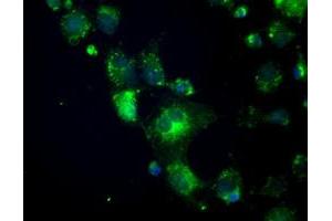 Anti-CRYAB mouse monoclonal antibody (ABIN2452579) immunofluorescent staining of COS7 cells transiently transfected by pCMV6-ENTRY CRYAB (RC202718). (CRYAB anticorps)
