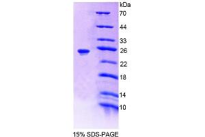 SDS-PAGE (SDS) image for Alanine Glyoxylate Aminotransferase (AGXT) (AA 182-371) protein (His tag) (ABIN4989132) (AGXT Protein (AA 182-371) (His tag))