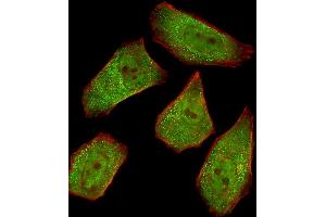 Fluorescent image of  cells stained with COL4A1 Antibody (N-term) A.