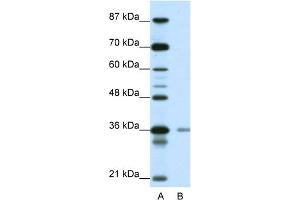 WB Suggested Anti-HIF1AN Antibody Titration:  0. (HIF1AN anticorps  (N-Term))