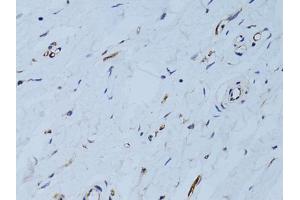 Immunohistochemistry of paraffin-embedded human breast using SELE Antibody. (Selectin E/CD62e anticorps)