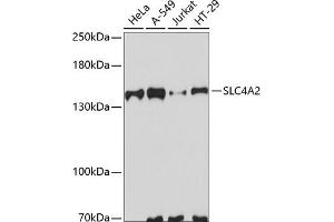 Western blot analysis of extracts of various cell lines, using SLC4 antibody (ABIN6129885, ABIN6148011, ABIN6148012 and ABIN6223666) at 1:3000 dilution. (SLC4A2 anticorps  (AA 200-300))