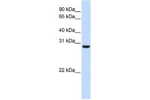 WB Suggested Anti-C18orf10 Antibody Titration: 0. (TPGS2 anticorps  (Middle Region))