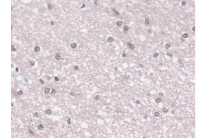 Detection of LMP7 in Human Cerebrum Tissue using Polyclonal Antibody to Large Multifunctional Peptidase 7 (LMP7)