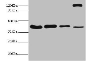 Western blot All lanes: NSFL1C antibody at 6. (NSFL1C anticorps  (AA 1-185))