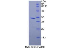 SDS-PAGE analysis of Mouse MYLK3 Protein. (MYLK3 Protéine)
