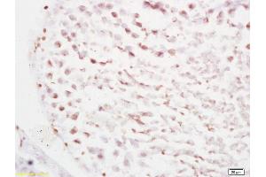 Formalin-fixed and paraffin embedded rat testis tissue labeled with Anti RBBP6/P2P-R Polyclonal Antibody, Unconjugated (ABIN687202) at 1:200 followed by conjugation to the secondary antibody and DAB staining