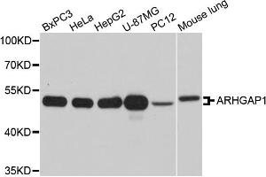 Western blot analysis of extracts of various cell lines, using ARHGAP1 antibody (ABIN5971927) at 1/1000 dilution. (ARHGAP1 anticorps)