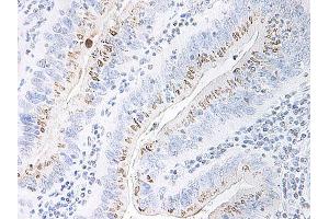 Image no. 1 for anti-Chemokine (C-X-C Motif) Ligand 2 (CXCL2) antibody (ABIN465915) (CXCL2 anticorps)