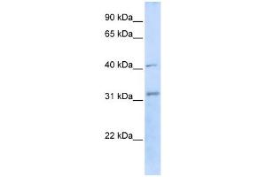 WB Suggested Anti-STUB1 Antibody Titration:  0. (STUB1 anticorps  (C-Term))