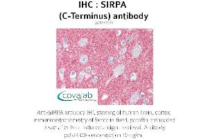 Image no. 2 for anti-Signal-Regulatory Protein alpha (SIRPA) antibody (ABIN1739273) (SIRPA anticorps)