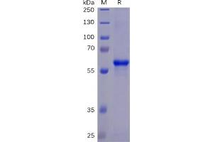 SARS-CoV-2 (2019-nCoV) S protein RBD, mFc-His Tag on SDS-PAGE under reducing condition.