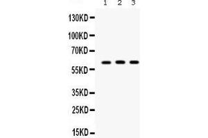 Western blot analysis of Staufen expression in PANC whole cell lysates (lane 1), A549 whole cell lysates (lane 2) and 293T whole cell lysates (lane 3). (STAU1/Staufen anticorps  (C-Term))