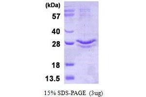 Glutathione Peroxidase 3 (Plasma) (GPX3) (AA 21-226), (U73C) protein (His tag)