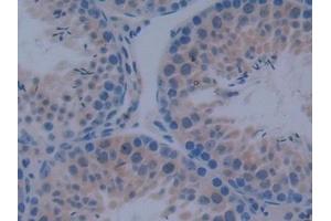 Detection of IkBd in Mouse Testis Tissue using Polyclonal Antibody to Inhibitory Subunit Of NF Kappa B Delta (IkBd) (IkBd anticorps  (AA 58-304))