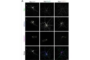 Representative confocal images showing the morphology of DIV21 primary hippocampal neurons over-producing mCherry (blue, circle highlights the complexity in panel 2, i. (Ankyrin G anticorps)