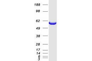 Validation with Western Blot