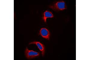 Immunofluorescent analysis of c-CBL (pY700) staining in HeLa cells. (CBL anticorps  (C-Term, pTyr700))