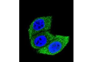 Confocal immunofluorescent analysis of HSA Antibody (ABIN659080 and ABIN2838072) with Hela cell followed by Alexa Fluor® 488-conjugated goat anti-mouse lgG (green).