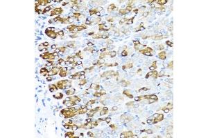Immunohistochemistry of paraffin-embedded mouse stomach using MGP antibody (ABIN5975376) at dilution of 1/100 (40x lens).