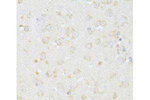 Immunohistochemistry of paraffin-embedded Mouse brain using CHRNA7 Polyclonal Antibody at dilution of 1:100 (40x lens). (CHRNA7 anticorps)