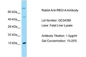 Host: Rabbit Target Name: REG1A Sample Type: Fetal Liver Antibody Dilution: 1. (REG1A anticorps  (C-Term))
