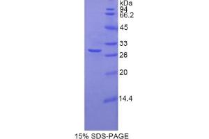 SDS-PAGE analysis of Rat TNNT1 Protein. (TNNT1 Protéine)