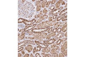 Immunohistochemical analysis of (ABIN656404 and ABIN2845698) on paraffin-embedded Human kidney tissue. (WFDC1 anticorps  (C-Term))