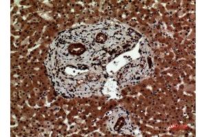 Immunohistochemistry (IHC) analysis of paraffin-embedded Human Liver, antibody was diluted at 1:100. (IL12A anticorps  (Internal Region))