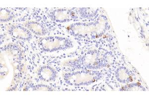 Detection of CTGF in Human Small intestine Tissue using Polyclonal Antibody to Connective Tissue Growth Factor (CTGF) (CTGF anticorps  (AA 248-349))